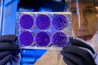 person in lab studying slides